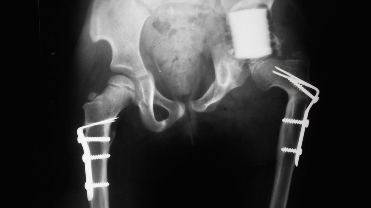 „Es war ein Experiment”