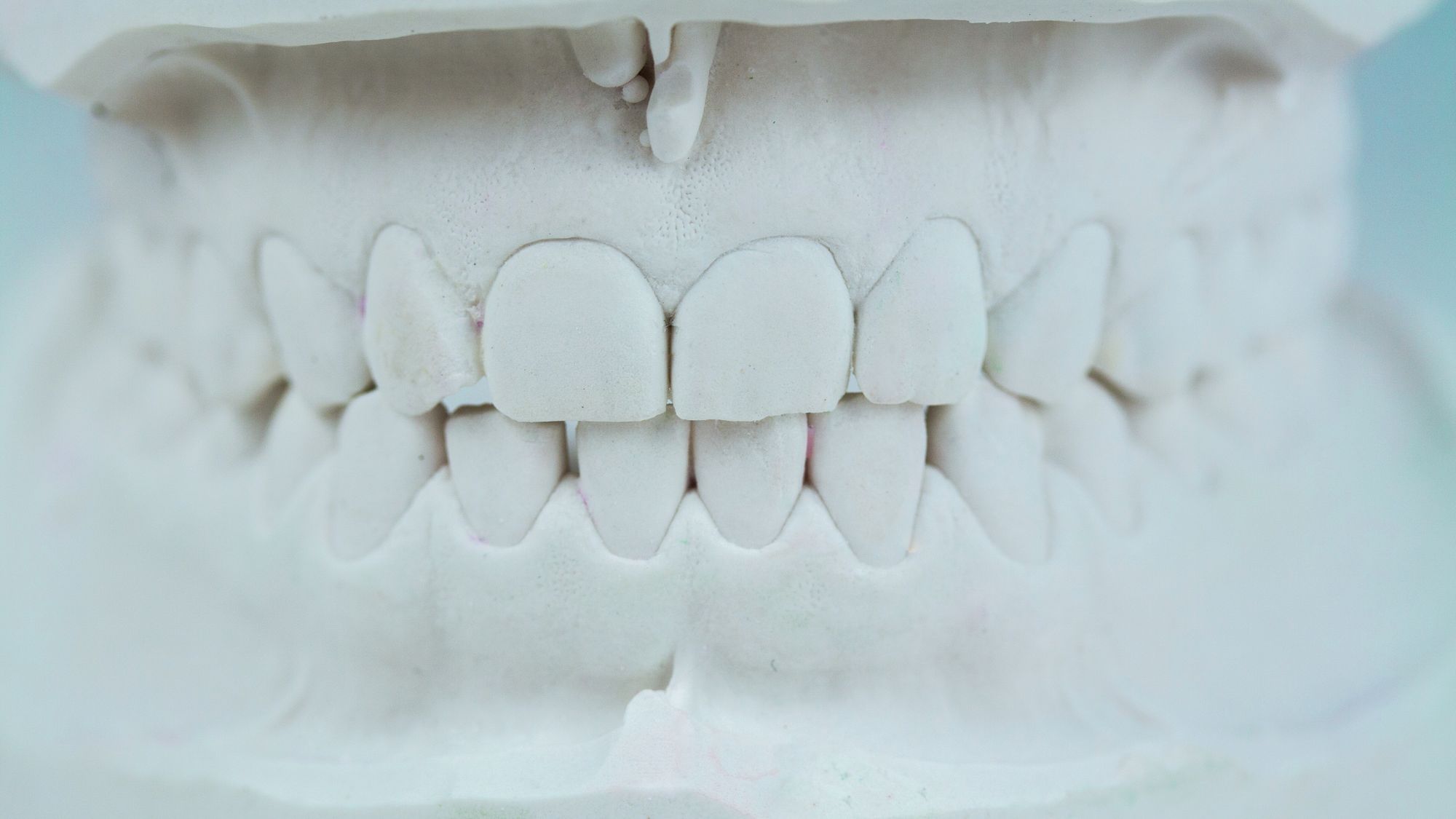 Wir knirschen mit den Zähnen – aber nicht nur, weil wir Stress haben