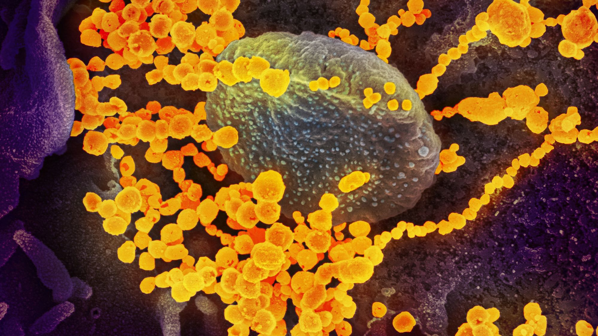 Wie ein Virus funktioniert, verständlich erklärt