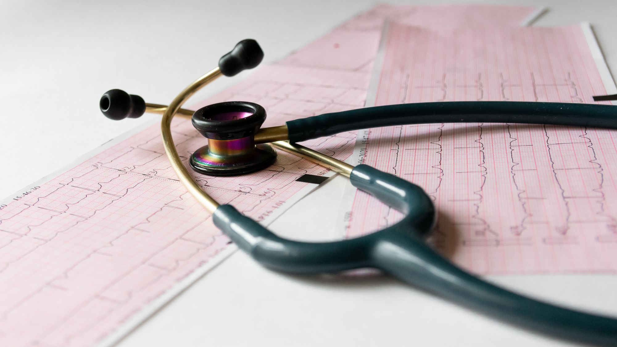 Stethoskop liegt auf einem langen Elektrokardiogrammband.