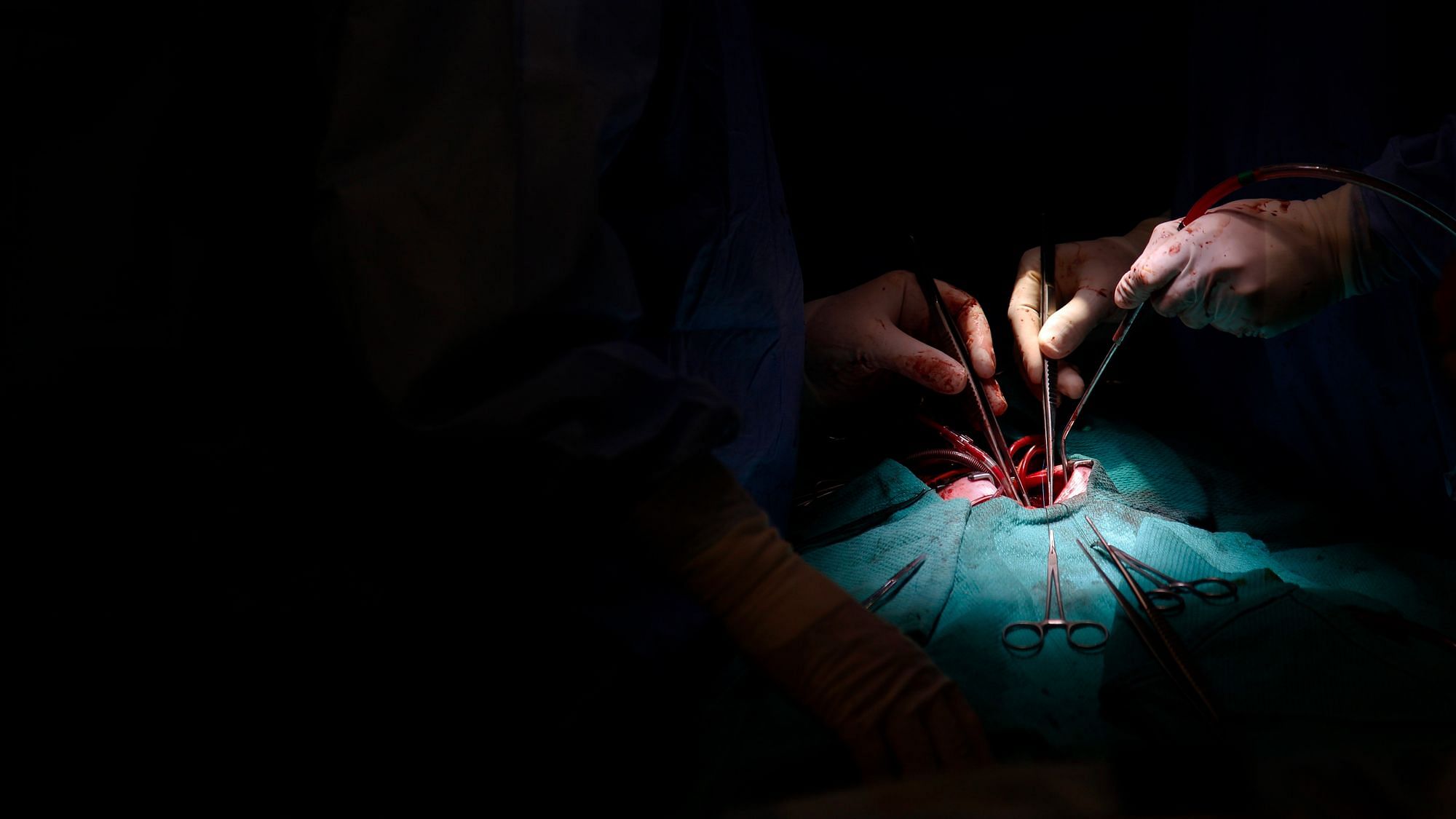 Ein schwarzes Bild mit einem Lichtpunkt auf die drei Hände von ChirugInnen, welche gerade in einem menschlichen Torso operieren.