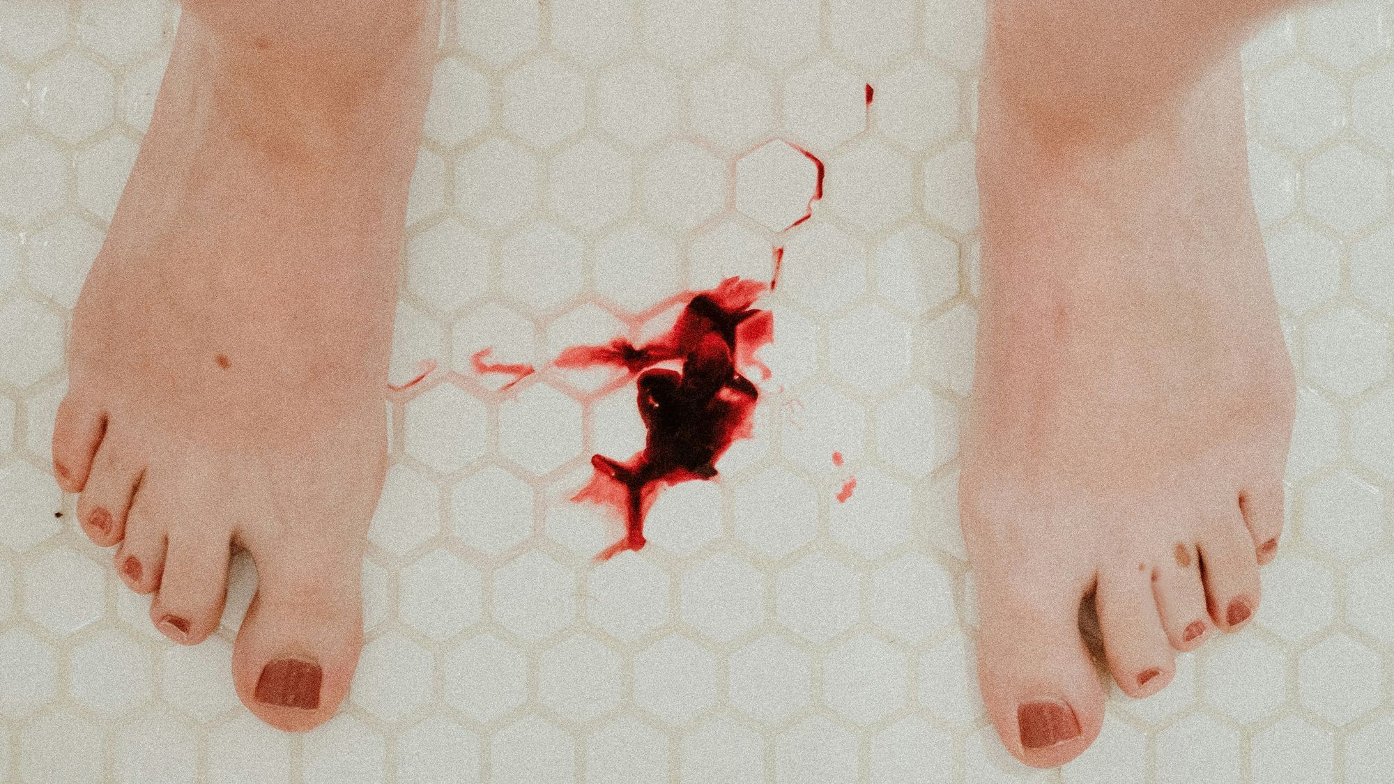 Nackte Füße in einer Wanne. Dazwischen ist ein Blutfleck.