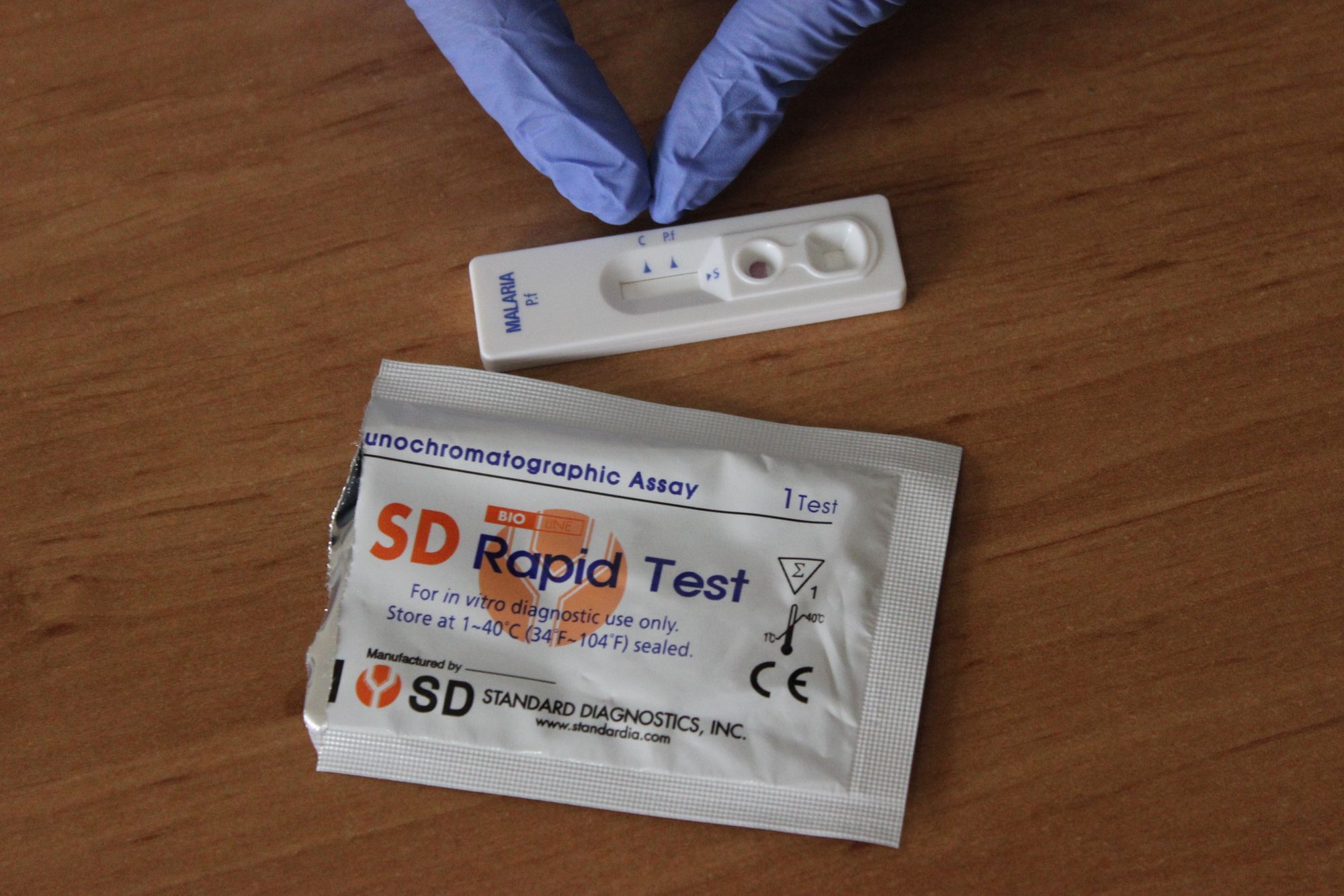 Auch Laien können selbst den Test machen. 