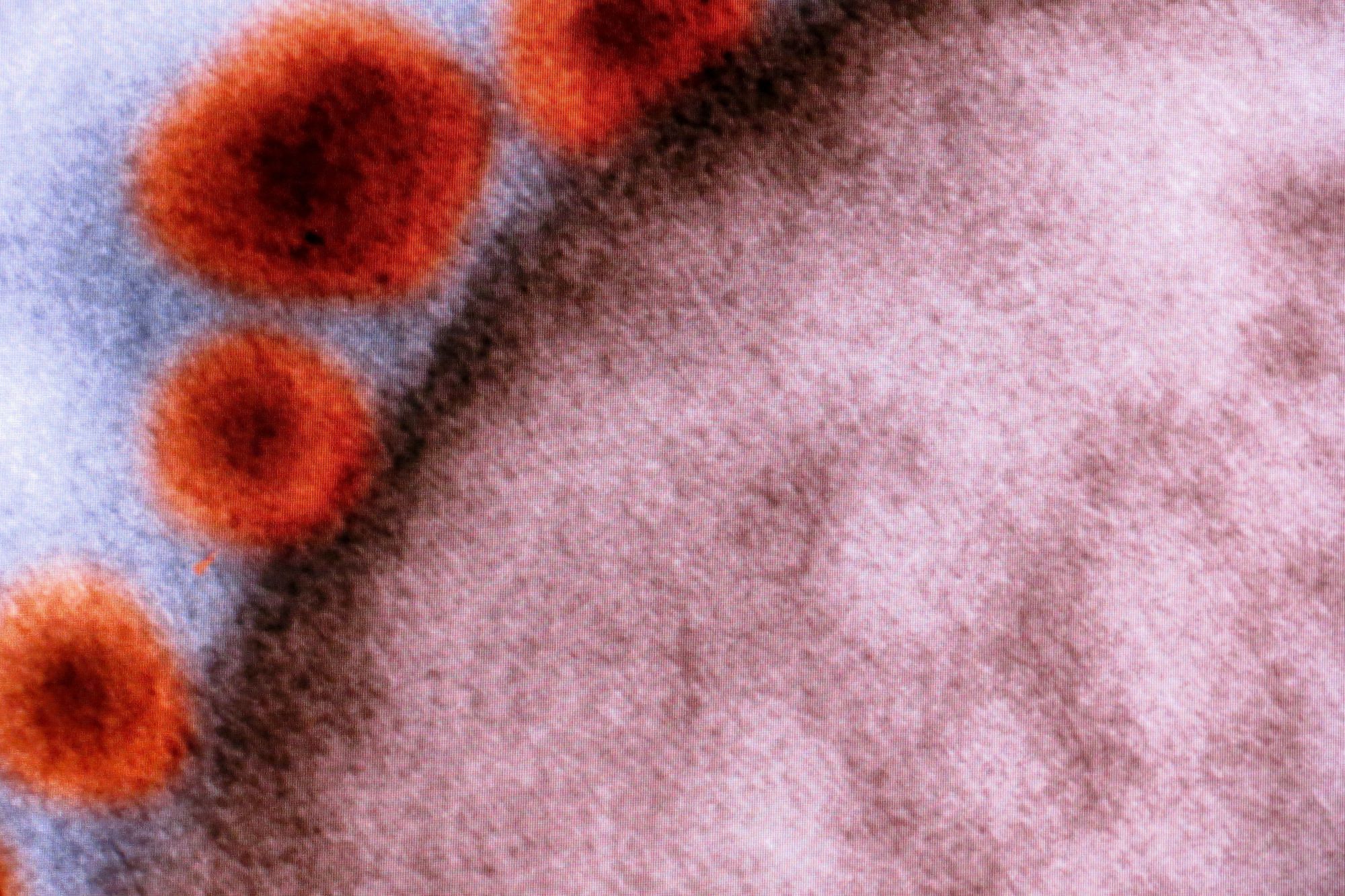 Zika unter dem Mikroskop.
