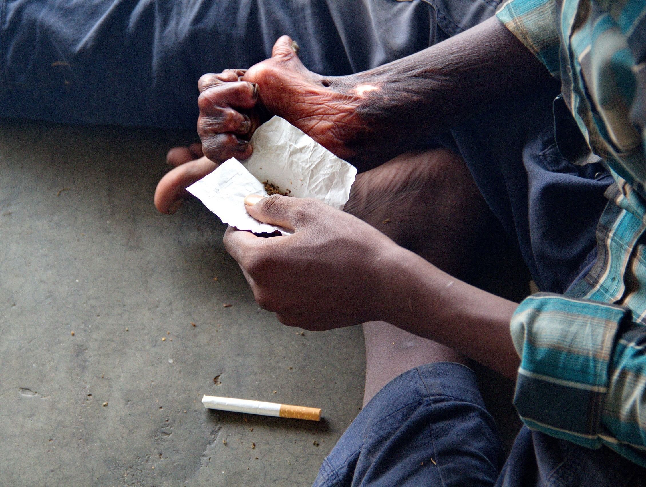 Die Hand dieses Mannes ist verbrannt. Warum, sagt er nicht. Er ist ein Bettler in Kamalapur. Vom erbettelten Geld kauft er Marihuana.