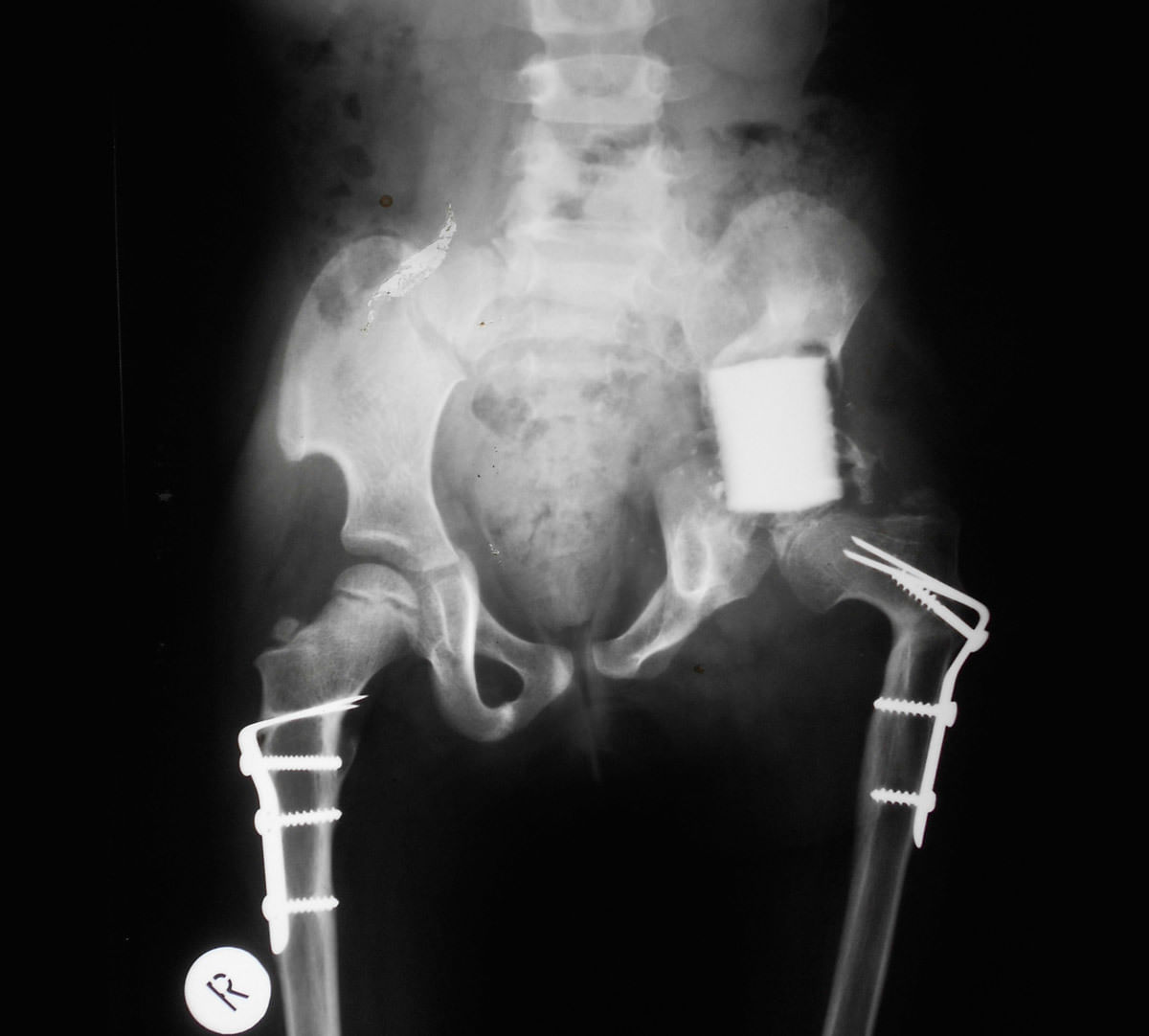 Röntgenaufnahmen einer Patientin von Gheorghe Burnei