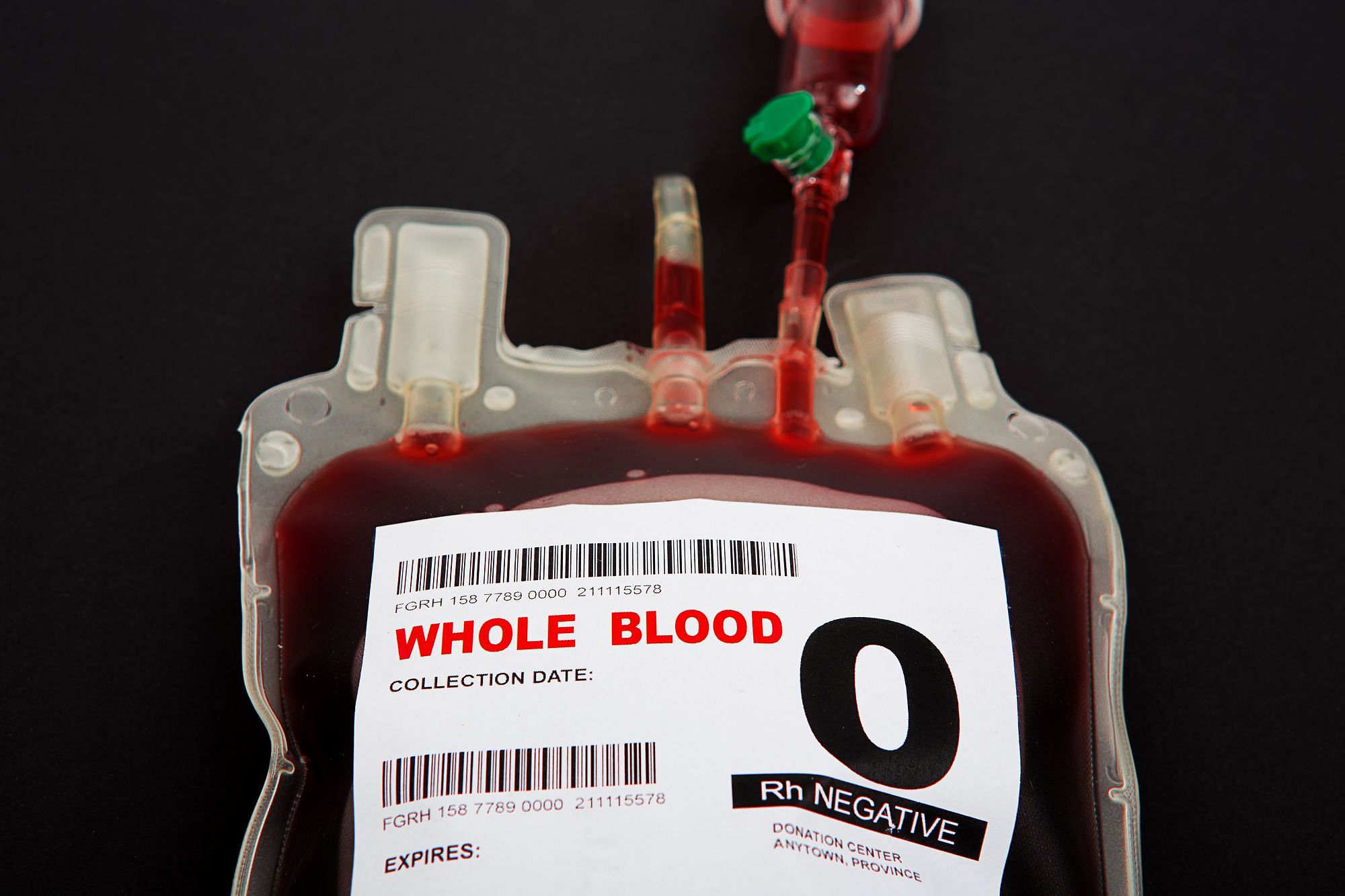 Blutspenden - in den USA ein Zusatzverdienst.