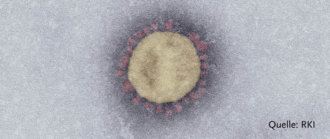 So sieht das neuartige SARS-CoV-2-Virus aus im Elektronenmikroskop.