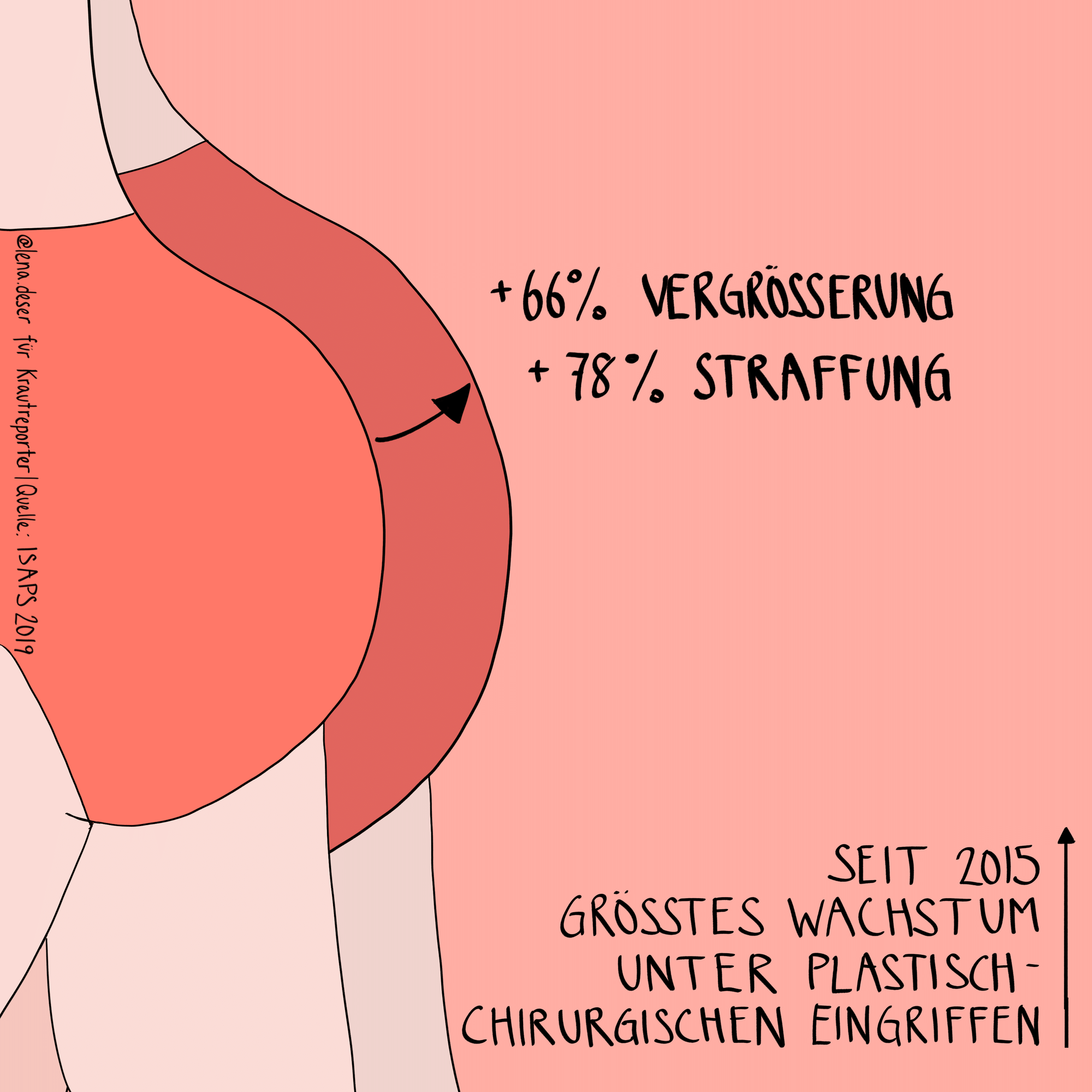 Immer mehr Frauen lassen sich den Po straffen