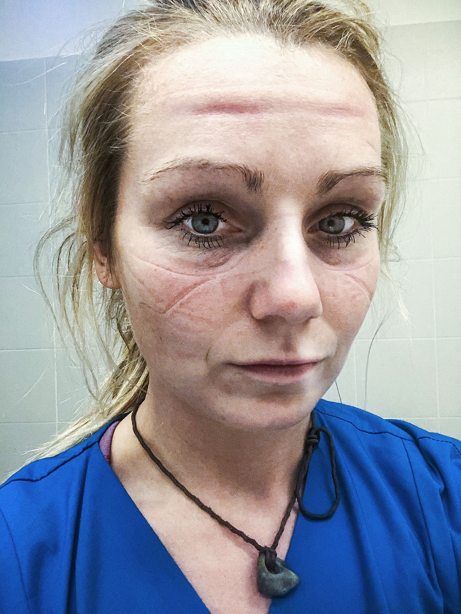 Portät einer müden Pflegerin mit sichtbaren Masken- und Sicht-schutzabdrücken