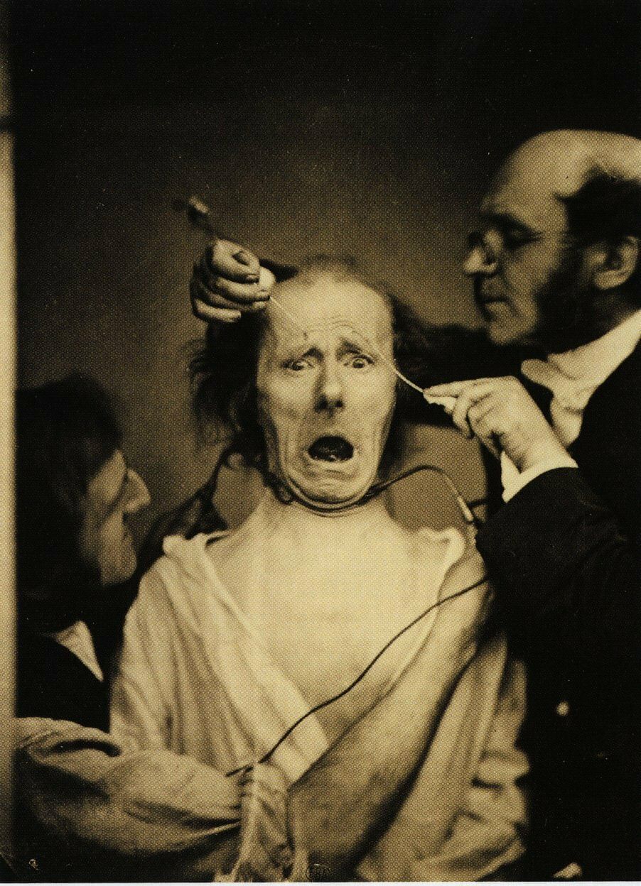 Wir sehen einen Patienten, der eine erschrockene Grimmasse zieht, und zwei Elektroden an den Kopf gehalten bekommt. Es ist ein sehr altes Foto in sepia.