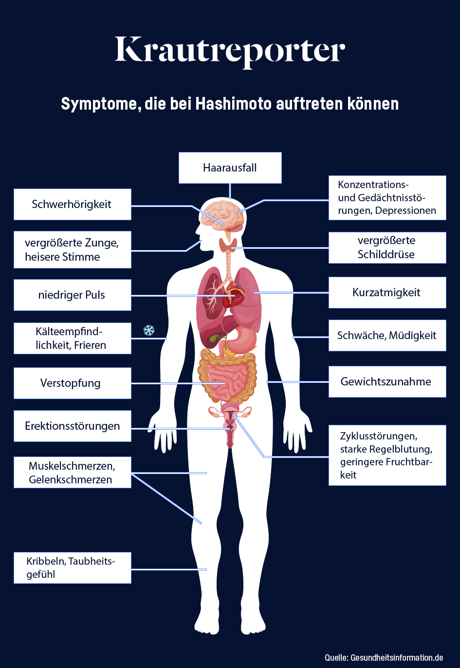 Die Grafik zeigt einen Körper, an dem die möglichen Symptome der Krankheit Hashimoto gezeigt werden.