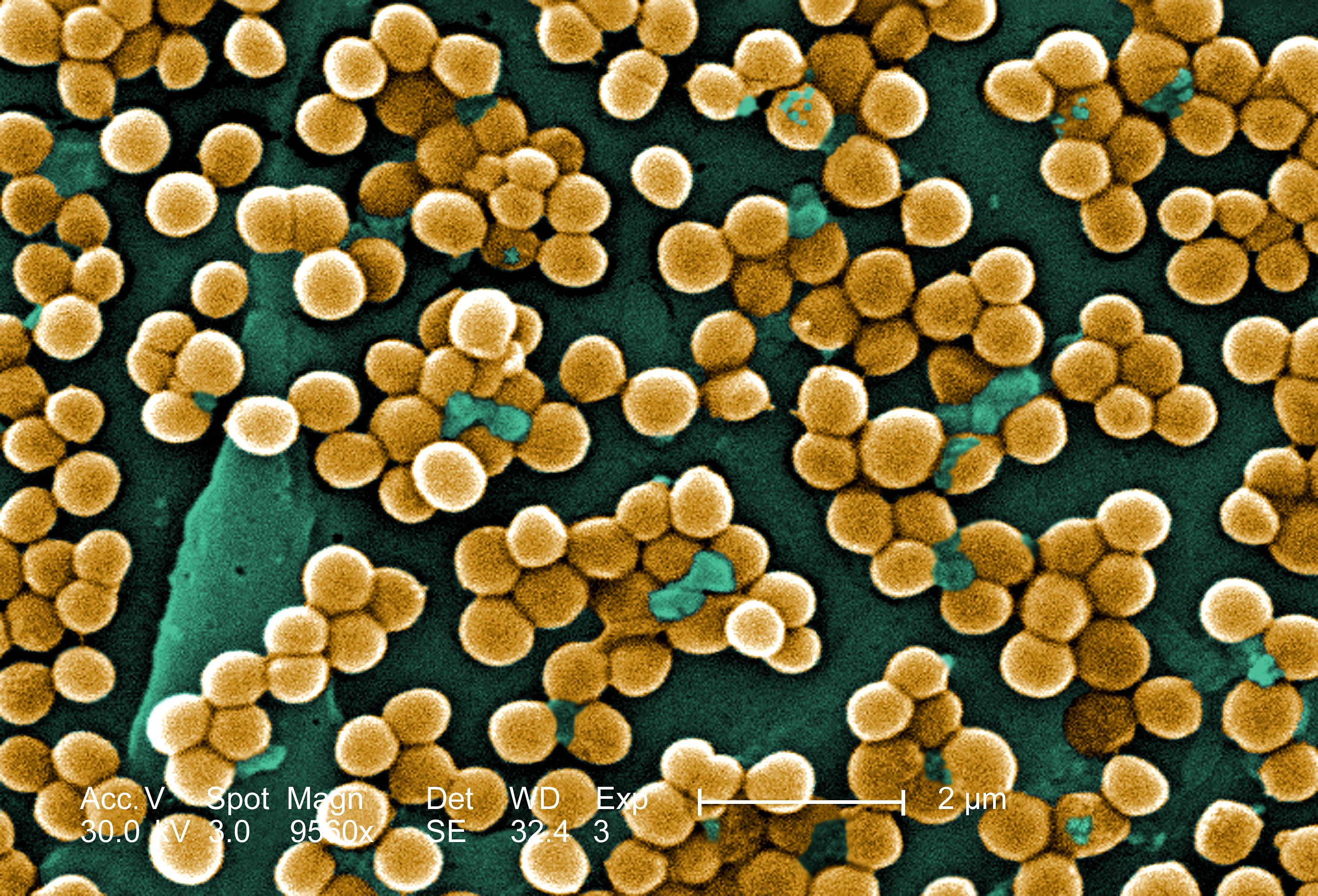 Methicillin-resistenter Staphylococcus aureus (MRSA)