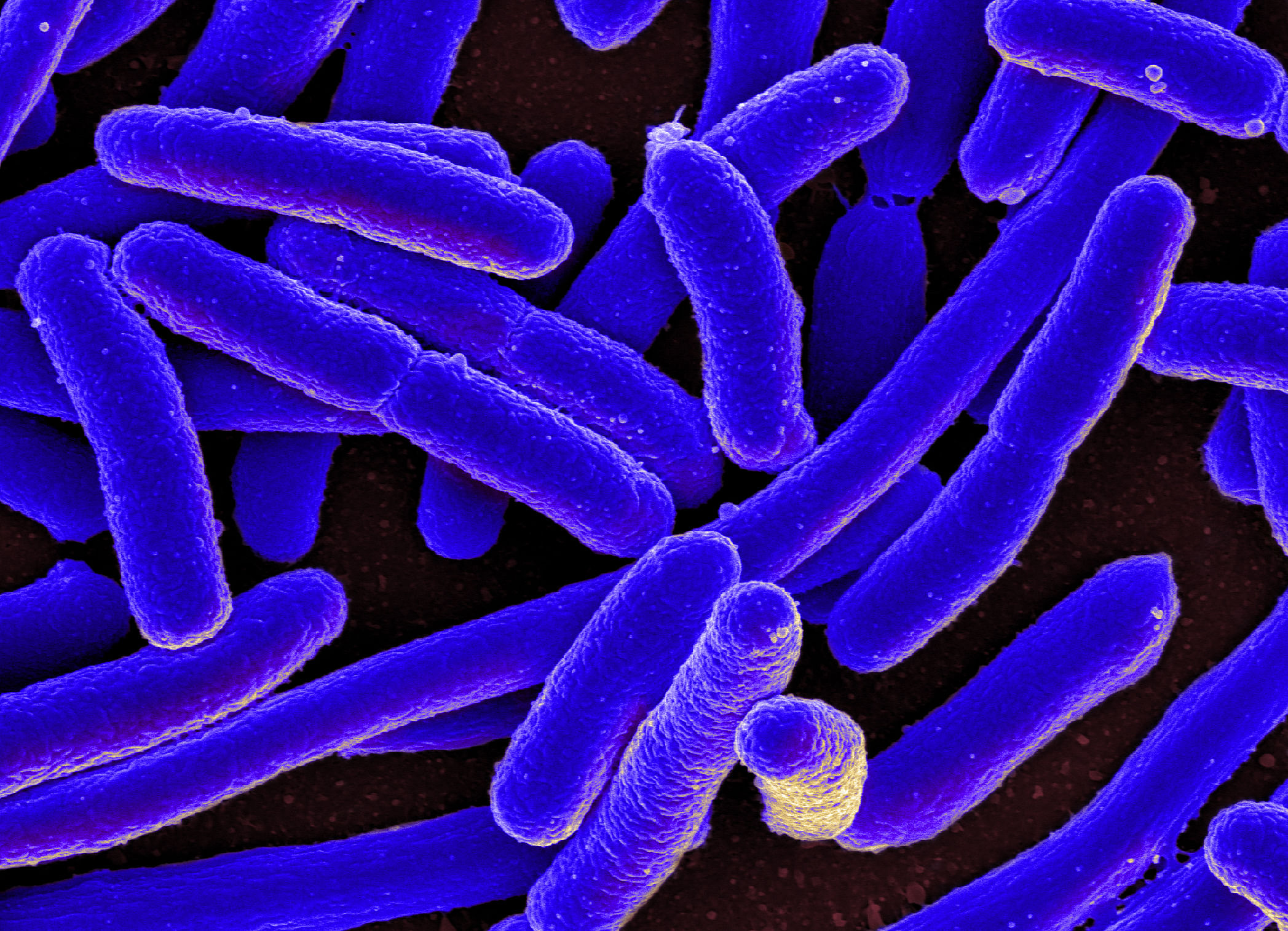 Blau-coloriertes Darmbakterium Escherichia coli